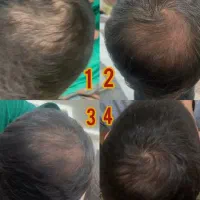 معجزه قرن/رشد ۳ برابری مو|آرایشی، بهداشتی، درمانی|خوشاب, |دیوار