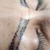 میکروبلدینگ