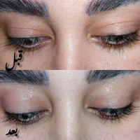 پاکسازی و فشیال تخصصی پوست و اموزش