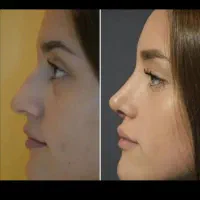 عمله تیمور خیابان طالقانی کوچه مهدی حیدری|خدمات آرایشگری و زیبایی|شوش, |دیوار