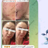 پک وایت روز|آرایشی، بهداشتی، درمانی|شیراز, آبیاری|دیوار