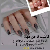 کاشت ناخن تخفیف ویژه