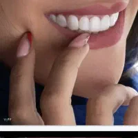 ثبت نام بیمه دندانپزشکی وکامپوزیت وزیبایی دندان|خدمات آرایشگری و زیبایی|گرگان, |دیوار