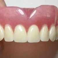 دندان مصنوعی طرح لبخند کامپوزیتی