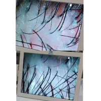 درمان ریزش مو،پوسته،شوره،خارش و بیماری های قارچی|خدمات آرایشگری و زیبایی|شیراز, شهرک امیر کبیر|دیوار