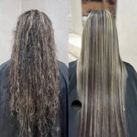 احیا و کراتینه درمانی