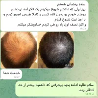 قطع ریزش در دوهفته|آرایشی، بهداشتی، درمانی|خوسف, |دیوار