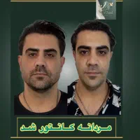 مدل خانم یااقا خوش چهره جهت تزریق فیلرو کانتورینگ|خدمات آرایشگری و زیبایی|تهران, فاطمی|دیوار