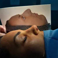 جشنواره جراحی بینی|خدمات آرایشگری و زیبایی|بروجرد, |دیوار