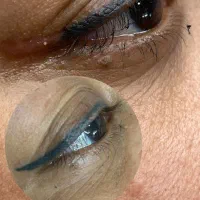 ریموو بایوتیک