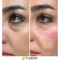 کلینیک پوست ، مو و لیزر|خدمات آرایشگری و زیبایی|شهریار, شهریار|دیوار