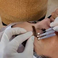 خدمات پوست ومو در کلینیک زیبایی الیا