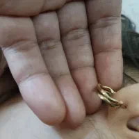 طلا گمشده