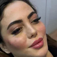خدمات زیبایی فـیلـربـوتـاکـس
