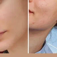 فیشال تخصصی پوست پاکسازی، آبرسانی و جوانسازی|خدمات زیبایی و سلامت|تهران, اباذر|دیوار