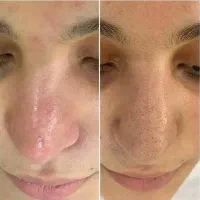 خدمات تخصصی پوست