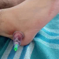 خدمات آموزشی حجامت و زالو درمانی