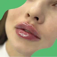 جشنواره یلدایی تخفیف ژل لب،بوتاکس توسط پزشک متخصص|خدمات آرایشگری و زیبایی|کرج, گلشهر|دیوار