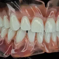 دندانسازی آرین ازکات