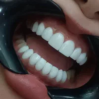 تخفیف ویژه کامپوزیت زیبایی و دندانپزشکی|خدمات آرایشگری و زیبایی|کرج, شاهین‌ویلا|دیوار