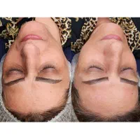 وقت مراقبت از پوستته(پاکسازی،پلاژن تراپی اسیدتراپی|خدمات آرایشگری و زیبایی|بابل, |دیوار