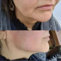 کلینیک زیبایی الارز پاداد ( کلینیک دکتر فتحی)|خدمات آرایشگری و زیبایی|اهواز, پادادشهر|دیوار