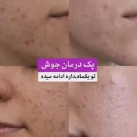 آموزش و خدمات فیشال فوق تخصصی صورت و بدن در کلینیک|خدمات آرایشگری و زیبایی|قم, سالاریه|دیوار