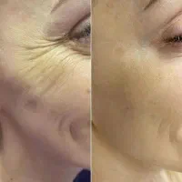 مشاور پوست و مو