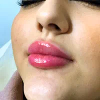 بلفاروپلاستی کاشت مو و ابرو نخ فیلر بوتاکس لیزر|خدمات آرایشگری و زیبایی|اندیشه, اندیشه فاز ۶|دیوار