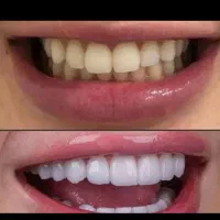 نیازمند دندانپزشک مجوز دار