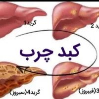 کبدچرب مرگ خاموش