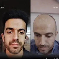 کلینیک/ جراحی بینی / ترمیم / تزریق ژل لب /|خدمات آرایشگری و زیبایی|تهران, سعادتآباد|دیوار