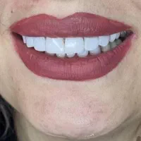 دندان مصنوعی|خدمات آرایشگری و زیبایی|اردبیل, |دیوار