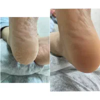 پدیکور تخصصی|خدمات آرایشگری و زیبایی|برازجان, |دیوار