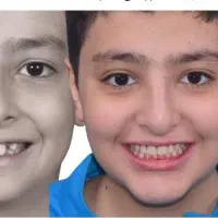 کامپوزیت فیسینگ ارتودنسی بزرگسالان و کودکان بیهوشی|خدمات آرایشگری و زیبایی|شیراز, زرگری|دیوار