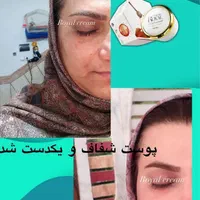 تنهانمایندگی کرم رویال ببرراضی نبودی پولتوپس بگیر
