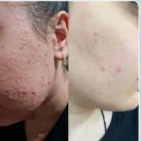 تا کی می‌خوای برای زیباتر شدن امروز و فردا کنی