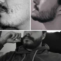 بمب پرپشتی .ریش هات ۲۲ روزه