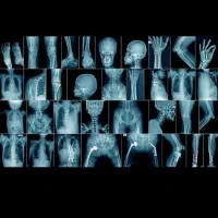 ضایعات عکسهای  رادیولوژی  توضیحات  خوانده شود