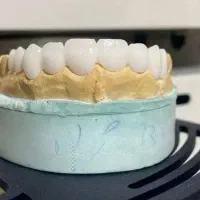 روکش دندان خرم آباد