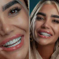 دندانپزشکی/لمینیت/کامپوزیت/جراحی دندان/ایمپلنت