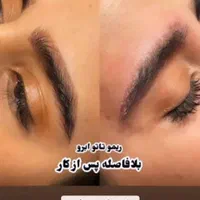 ژل بوتاکس،لابیاپلاستی،حذف لک،ریموو تتو،لاغری|خدمات آرایشگری و زیبایی|ارومیه, |دیوار