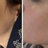 کلینیک سیب سبز ژل و بوتاکس از ۹۰۰ هزار تومان