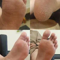 آف ویژه آموزش و خدمات پدیکور و کفسابی پا و ناخن|خدمات آرایشگری و زیبایی|مشهد, ولیعصر (شهرک غرب)|دیوار