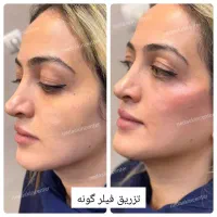 پوست مو زیبایی|خدمات آرایشگری و زیبایی|تهران, طیب|دیوار