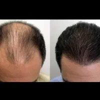 اعتماد به نفس از مو شروع میشه
