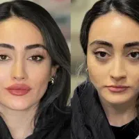 زیبایی پوست و بدن