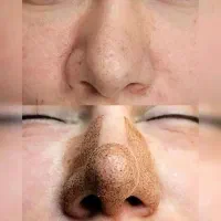 پلاسما .پلکسر|خدمات آرایشگری و زیبایی|زرند, |دیوار