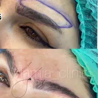 تزریق ژل و بوتاکس-چربی|خدمات آرایشگری و زیبایی|اهواز, کیانپارس |دیوار