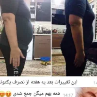 درمان چاقی با مشاوره رایگان